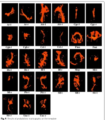 Fig. 4 Results of probabilistic tractography on the template