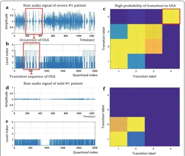 Fig. 2 Representative example of the time domain analysis of sleep sound. values, which is calculated by (the OSA severe group and a A raw audio data example of b its quantized signal’s energy