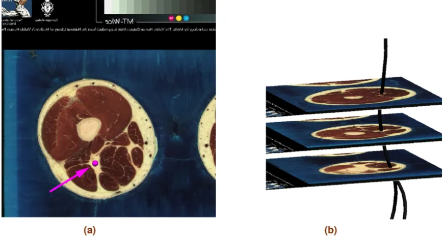 Figure 1Digitising and fittingDigitising and fitting. An illustration of the nerve digitisation and fitting process