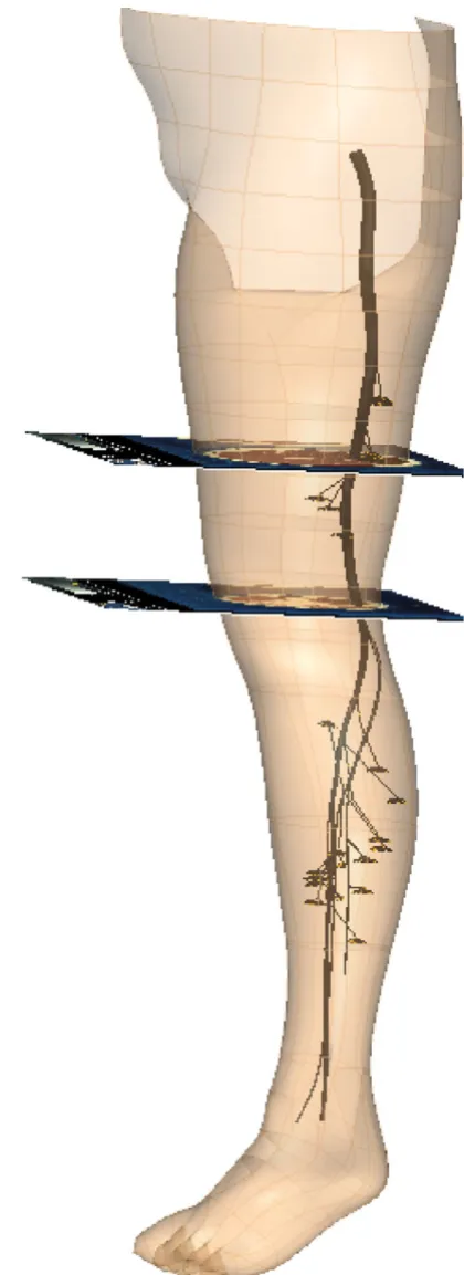 Figure 4 shows the completed nerve model inside the leftlower limb with two of the VH images used in the modelconstruction.