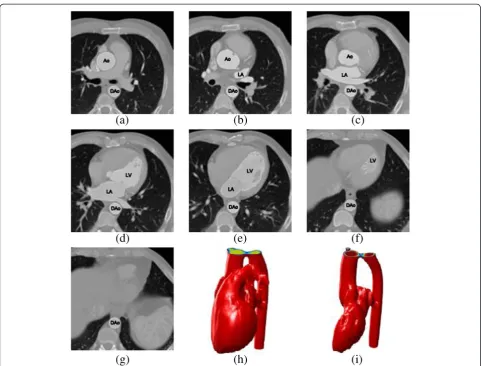 Figure 12 Example of the outcome of the proposed segmentation methodology. (a-g) Left heart segmentation of several slices from a CTscan, (h) 3D reconstruction of the whole heart, and (i) 3D reconstruction of the left heart.