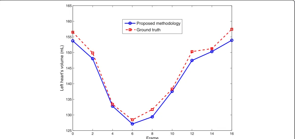 Figure 13 Example of left heart’s (LA + LV) volume vs. time curve for dynamic 3D sequence.