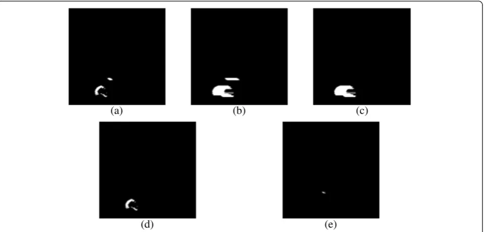 Figure 6 Automatic selection of the ROI. (a)(column #70 highlighted),highest area, and Original slice, (b) binary mask computed by thresholding with μ(k), (c) object of highest area (d) one-dimensional profile corresponding to the column #70, (e) outcome of the proposed algorithm, (f) object of (g) masked slice (region of interest).