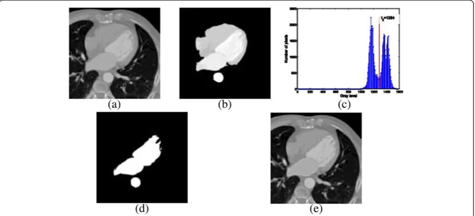 Figure 10 Computation of the final mask. (a) Original slice, (b) binary mask computed by thresholding with μglobal, (c) objects witha size higher than amin, (d) common area of binary masks in the considered axial range, (e) final (i.e., post-processed) binary mask, and(f) segmented slice.