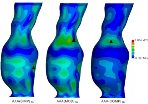 Figure 8stress in all the linearly elastic models examinedon the inner surface of the AAA wall
