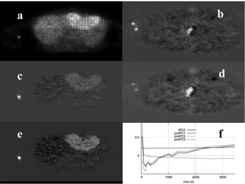 Figure 5 shows the results from the application of a skew-sICA to the dynamic PET study shown in figure 1