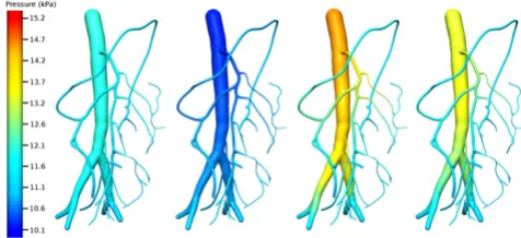 Figure 9Velocity distribution of the 1D mesenteric artery networkVelocity distribution of the 1D mesenteric artery network