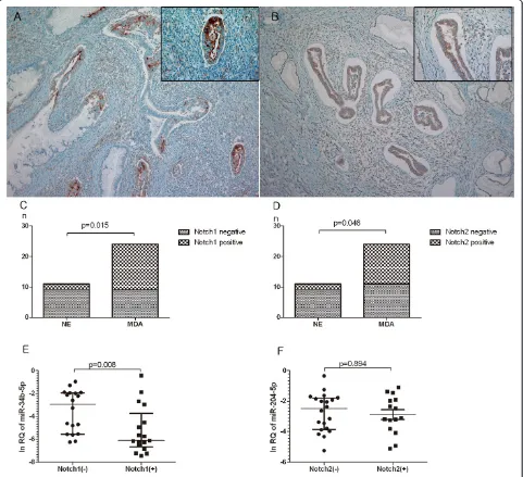 Figure 3 Immunohistochemical staining of Notch1 and Notch2 in minimal deviation adenocarcinoma (MDA) of uterine cervix and theirendocervical tissue (NE)