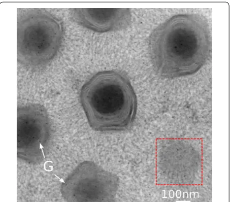 Fig. 2 TEM micrograph of a plastic section containing Mimivirus viri-ons infecting a cell culture at 4h post infection