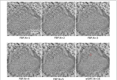Fig. 3 Mimivirus reconstruction: comparison of XY views of the capsid layer. Tomogram slices corresponding to the∼ boxed area in Fig