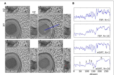 Fig. 4 Mimivirus reconstruction obtained from different schemes. A Tomogram views (XY, YZ, and XZ) of a giant Mimivirus generated from the first tilt series (N = 1) and the whole set (N = 16), both with FBP and wSIRT