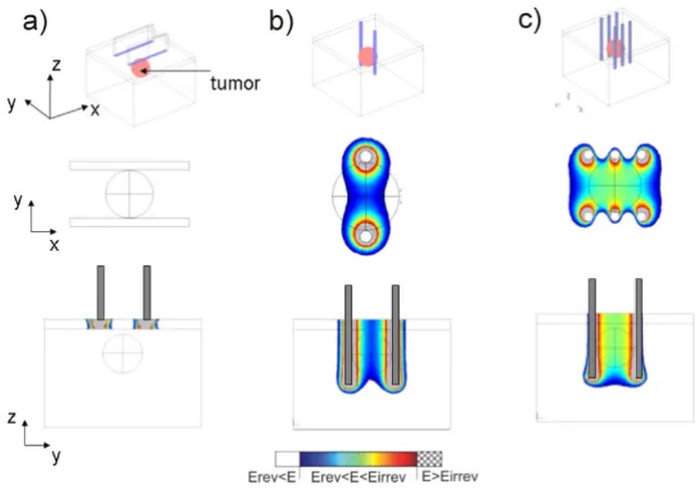 Figure 9Local electric field in subcutaneous tumour model obtained by using different electrode configurationsLocal electric field in subcutaneous tumour model obtained by using different electrode configurations