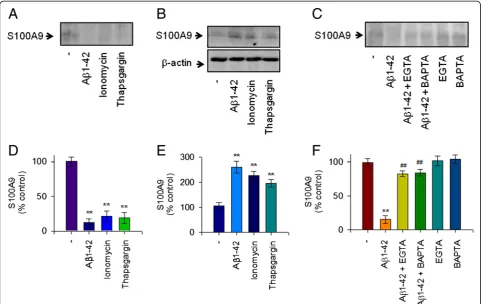 Figure 4 The decreased extracellular S1009A in response to Aβ1-42 monomers is dependent on increase of intracellular Ca2+ level inhuman THP-1 monocytes