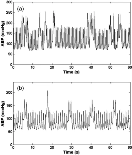 Figure 5Hz) 1/fquency artifact generated with band-limited (1.5 Hz to 18 Artifact 5, (noiseahf); Real (a) and Simulated (b) ABP high fre-Artifact 5, (ahf); Real (a) and Simulated (b) ABP high frequency artifact generated with band-limited (1.5 Hz to 18 Hz) 1/f2 noise.