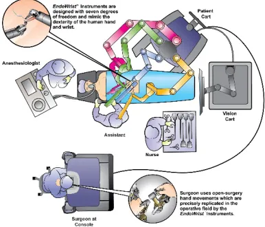 Figure 2 Robotic Surgery System 