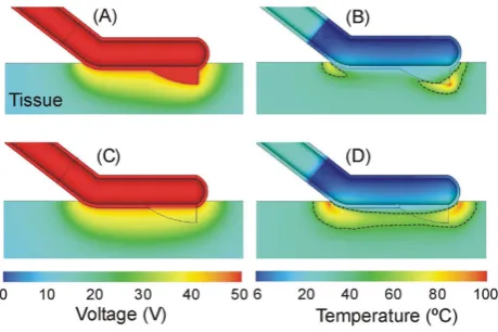 Figure 7 shows the voltage and temperature distributionsin the tissue for the two computational models: metalblade (A and B) and insulated blade (C and D).