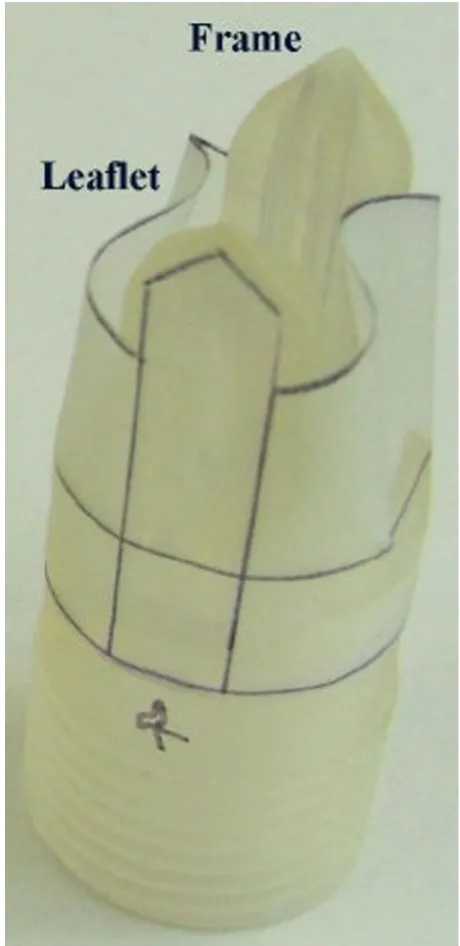 Figure 1design: a solid frame and a flexible leafletThe two main components of the novel, second-generation The two main components of the novel, second-gen-eration design: a solid frame and a flexible leaflet