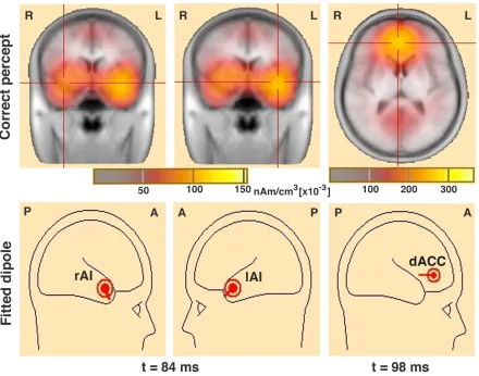 Figure 3.3 Spatiotemporal profiles of peak source-level brain activity over the SN nodes