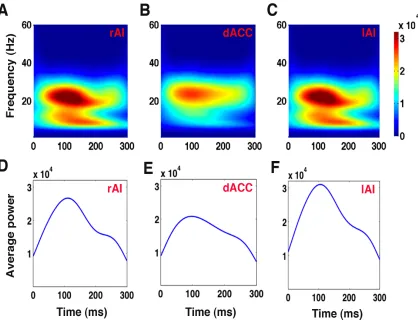 Figure 3.4 Power spectra of the SN nodes as a function of time and frequency for stimuli with 0% noise