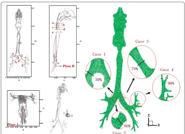 Fig. 1 Three dimensional models of normal and abnormal respiratory airway