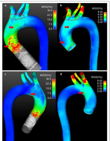 Fig. 8 The contour of WSS under both cases. port. a, c Illustrate the WSS distribution under series type LVAD sup-b, d Show the WSS distribution under normal case