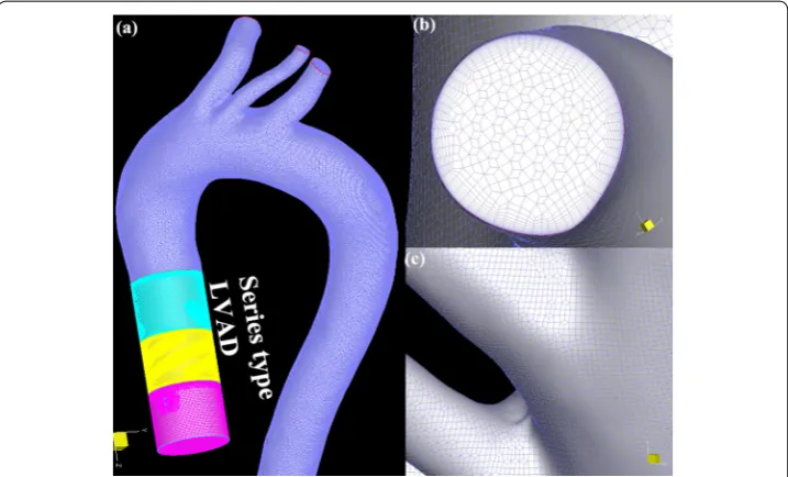 Fig. 2 The finite element model used in this study