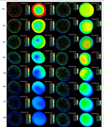 Fig. 6 The contour and vector of blood velocity at cross sections (S1–S8) under both cases