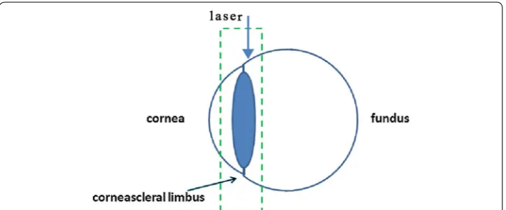 Fig. 1 The laser exposed surface of eye from limbus vertically, sequential images with step length of 5 μm were then collected through the trans-scleral imaging