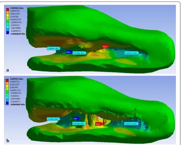 Fig. 8 Distributions of the directional deformation of the TM model after the finite element modeling analy-sis with the simulated pressure in 60 Pa