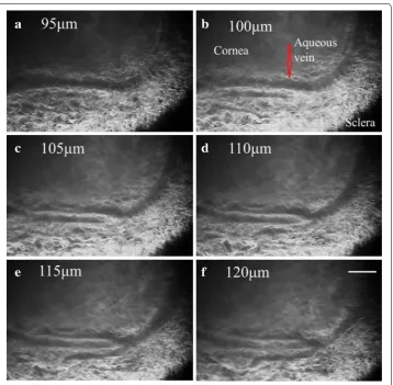 Fig. 11 3D reconstruction of the aqueous veins in the intact rat eye