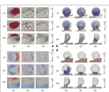 Table 2 Intra-aneurysmal average velocity and  the Rf under  non-stent, initial stent, and optimal stent placements of S, C, and R models, respectively