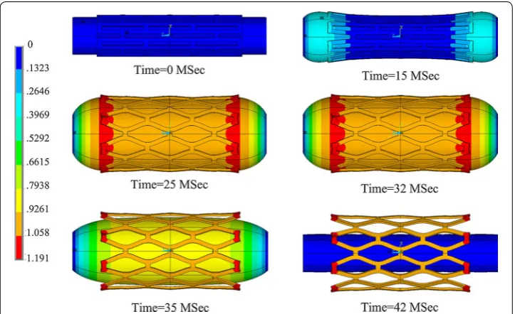 Fig. 4 Stent expansion process symmetrical displayed in the circumferential direction