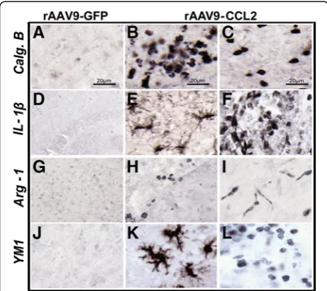 Figure 6 Induction of microglial markers of classical activation(K)markers representing the M1 activation state: calgranulin B(Calg.B or S100-A9:morphology stained for each marker