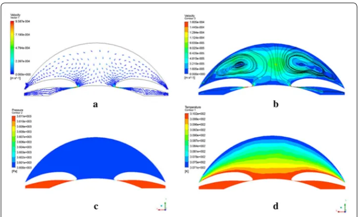 Fig. 7 The velocity vector (a), streamline (b), pressure (c), and temperature (d) distribution with the gravity in the −y direction and the outlet pressure in 27 mmHg, which simulating the high IOP patient in supine position