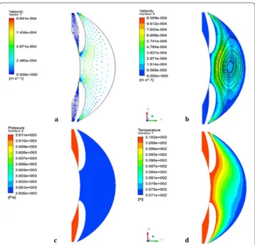 Fig. 8 The velocity vector (a), streamline (b), pressure (c), and temperature (d) distribution in −x gravity direction and the outlet pressure in 27 mmHg, which simulating the high IOP patient in sitting position