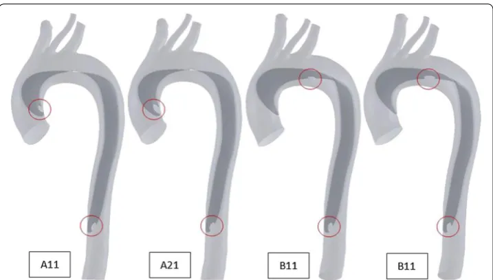 Table France). The final four models are shown in Fig. 1.