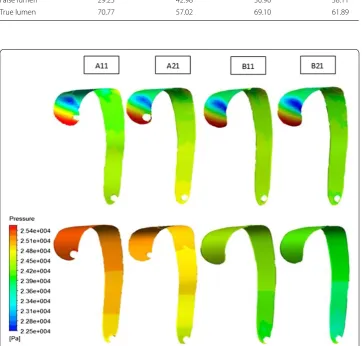 Table 3 Percentage of flow rate into the true and false lumens in different AD cases