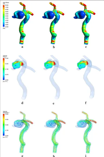 Fig. 2 Demonstration of wall shear stress a–c velocity plane, d–f and streamline, g–i in three stenting mod-els created by different methods