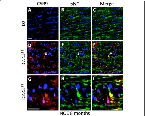 Figure 4 Membrane attack complex (MAC) deposition in dystrophic axons during early glaucoma in D2.C5B6 optic nerves