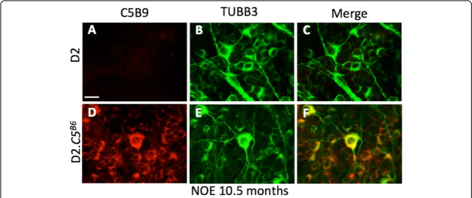 Figure 5 Membrane attack complex (MAC) deposition in retinal ganglion cell (RGC) soma in D2.C5B6 mice