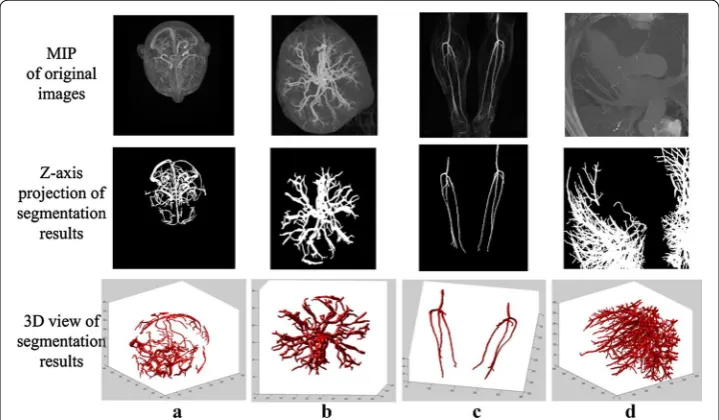 Fig. 6 The mixture model fitting results from the angiographic image data of the anatomical parts of the  a brain, b placenta, c legs, and d thorax