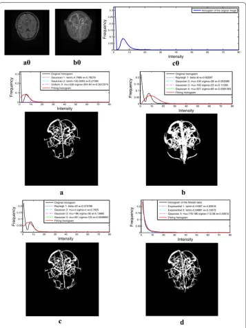 Fig. 9 Segmentation results of a single MRA data set from the hospital. of the MRA data