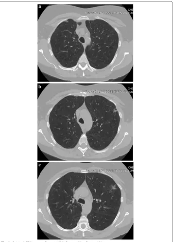 Fig. 2 Original CT frames. a Frame 117, b Frame 138, c Frame 159