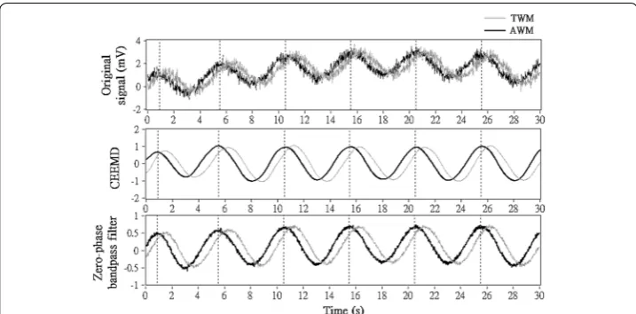 Fig. 7 The phase delay of the simulated signals, introduced by the linear‑phase band‑pass filter