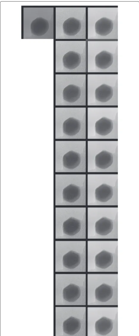 Fig. 15 An illustration of CS inversion from 10 frames compressedinto 1. The top left image shows the compressed frame, the middlecolumn of images shows the reconstructed frames, and the rightcolumn shows the original frames