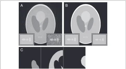 Fig. 9 Noisy misaligned reconstruction processed with Weka. a The noisy misaligned reconstruction from Fig