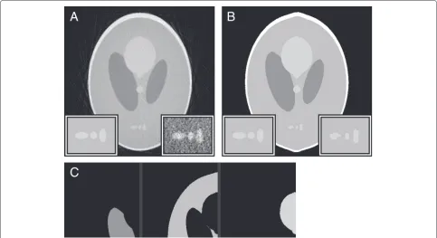 Fig. 10 Missing wedge reconstruction processed with Weka. a The perfectly aligned, noiseless 28 ° missing wedge reconstruction from Fig