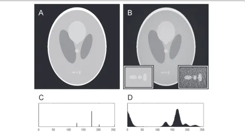 Fig. 1 Reconstruction artefacts raw (a) and WBP-reconstructed versions of a modified Shepp-Logan phantom (b) with their histograms shown in (c)and (d), respectively