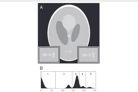 Fig. 2 Thresholded reconstruction. a The result of a 5-level Otsu threshold on the reconstructed image in Fig