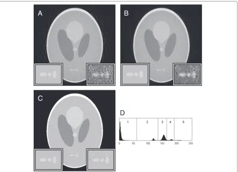 Fig. 4 Noisy misaligned reconstruction, processed with NAD. a A WBP reconstruction of projections which have been randomly misaligned andgiven Poisson noise